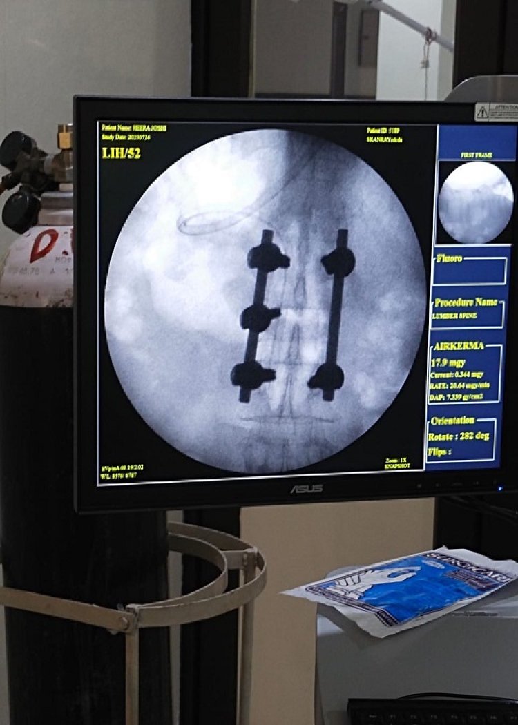 जिला अस्पताल में लंबर स्पाइन का सफल ईलाज
